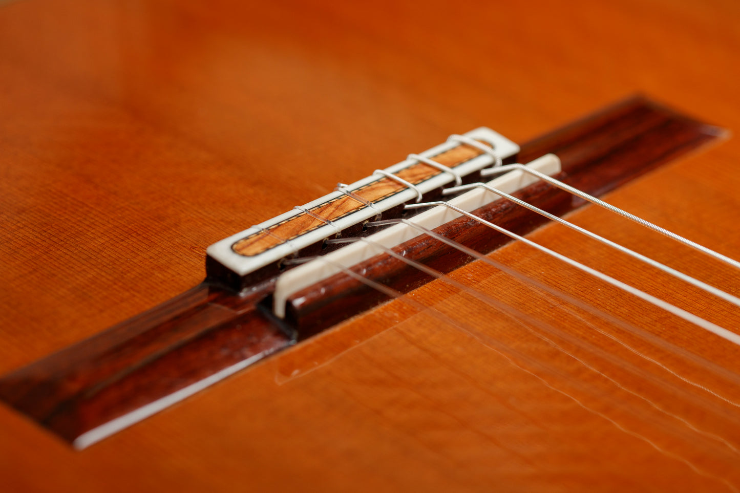 Antonius Müller 2016 (ex. Adam Holzman) – Cedar Double Top, Indian Rosewood