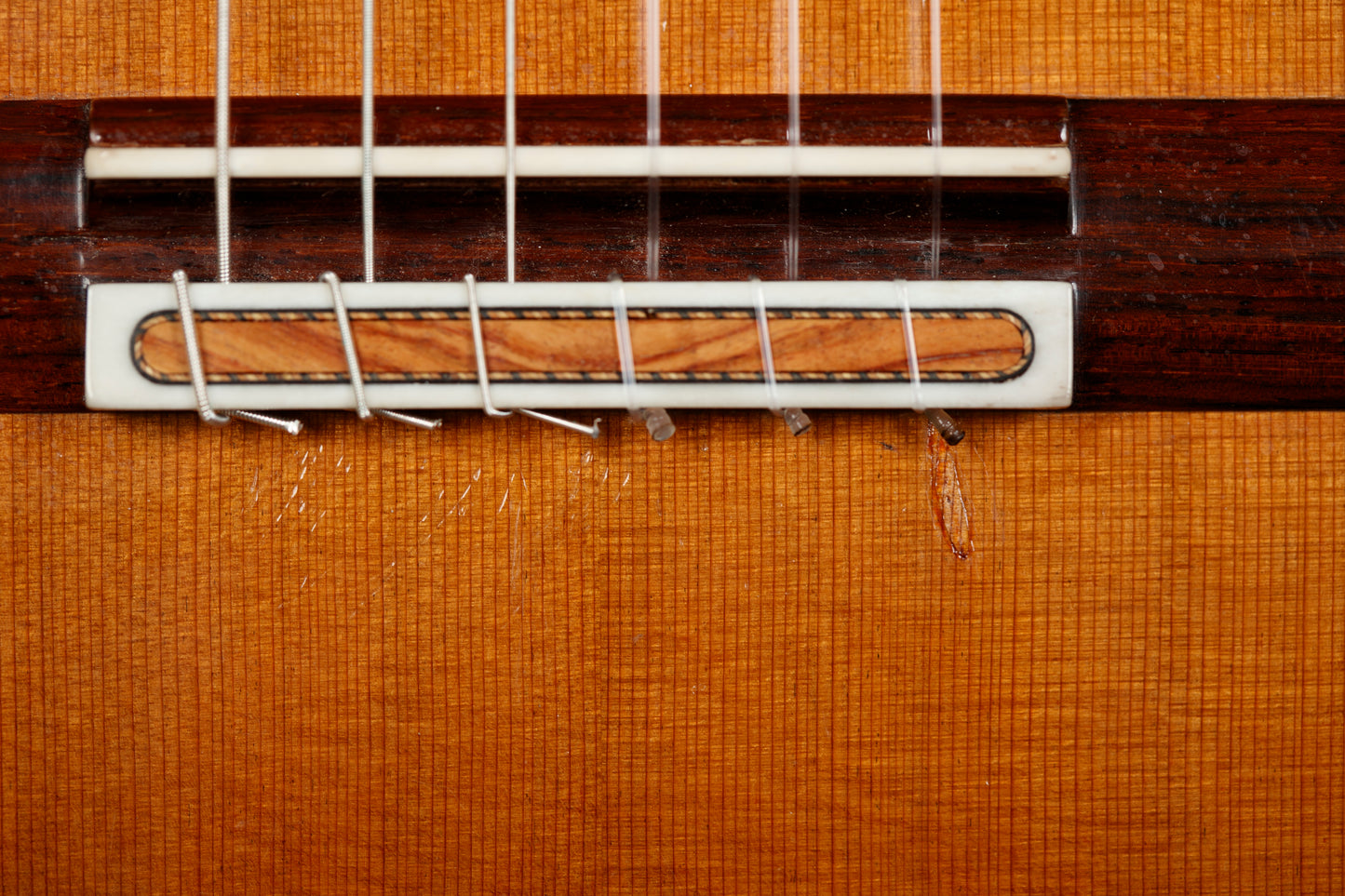 Antonius Müller 2016 (ex. Adam Holzman) – Cedar Double Top, Indian Rosewood